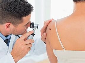 the doctor examines the papilloma, recommending removal with medication